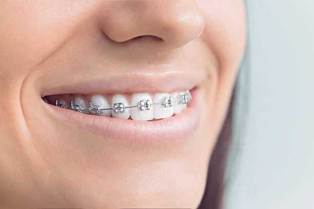 Best Wisdom Tooth Removal  in Greybull, WY